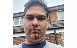 Ali Mashhadi's bloodied face after an alleged racist attack